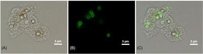 Interaction of Talaromyces marneffei with free living soil amoeba as a model of fungal pathogenesis